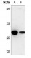 Anti-Cathepsin Z Antibody
